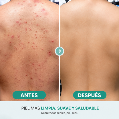DERMASKIN™| GEL DE LIMPIEZA E HIDRATACION PROFUNDA 100% EFECTIVO