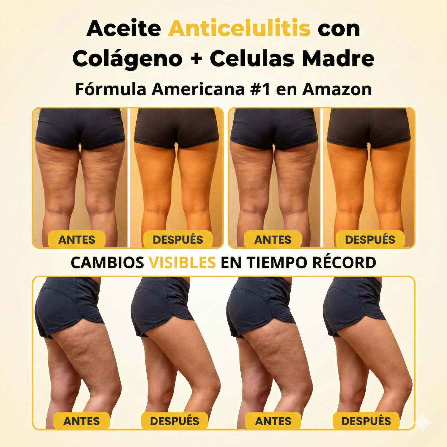 DermaLuxe™| Elimina estrías y da firmeza a la piel