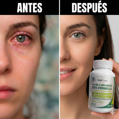 EverVision Pro™| Elimina las molestias oculares| 60 Unidades