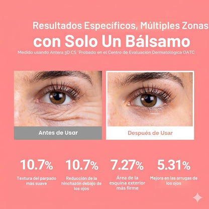 DermaLift™ | Borra líneas de expresión y devuelve el glow a tu piel en segundos